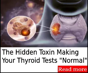 can thyroid issue cause weight gain